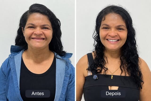 Dona Ednalva antes e depois do tratamento