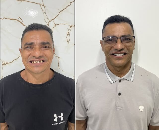 Seu José Pereira antes e depois do protocolo